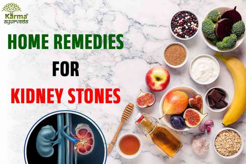 Home Remedies for Kidney Stones